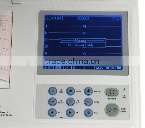 OEM Six Channel Digital ECG Machine 12-lead Digital 6-channel Electrocardiograph photo-6