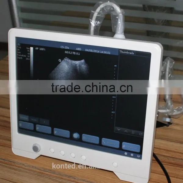 Full Digital Medical Ultrasound Scanner With Ce Marked photo-2
