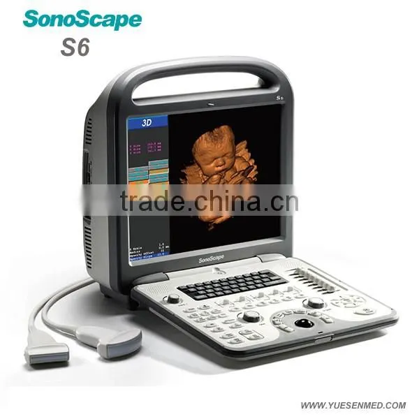 4D Portable Color Doppler Ultrasound Price