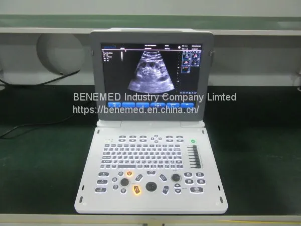 Echo Color Doppler Ultrasound Scanner Bene-5 photo-3