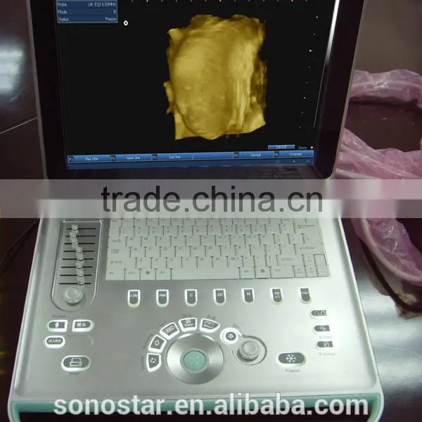 SS-9 PC Based Laptop Ultrasound B Scanner photo-5