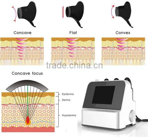 Pigment Removal Most 1.0-10mm Advanced Hifu Slimming Machine 4MHZ photo-6