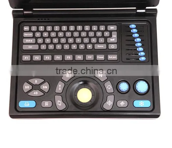 CE Approved Notebook Ultrasound Scanner With 3.5Mhz Multi-frequency Convex Probe RUS-9000E2 photo-3