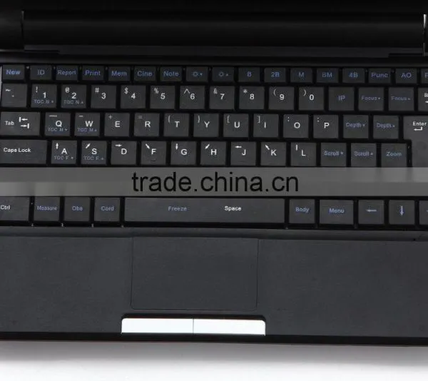 CE, ISO 13485 Approved Black Color Diagnostic Digital Ultrasound Scanner for Animal photo-5