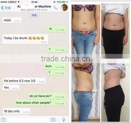 Cellulite Reduction Professtional Fat Freezing Slimming !!!! Body Reshape Rf Cavitation Cryolipolysis Fat Freeze Liposuction Machine photo-2