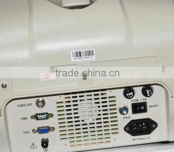 2016 CE Approved Digital Portable Style Ultrasound Machine/Scanner With Cheap Price photo-4