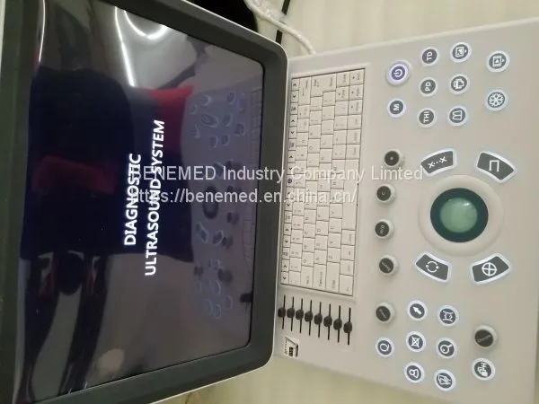 Ultraslim Notebook Type Black and White Ultrasound Scanner Machine Bw-8 photo-3