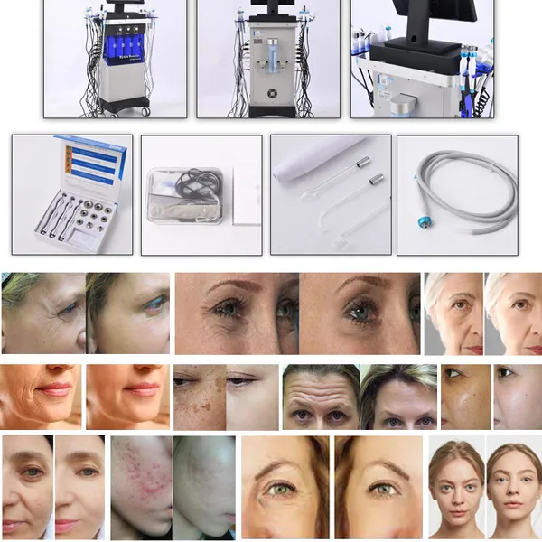 2024 Beauty Salon Use 14 in 1 Hydra Micro Dermabrasion Aqua Peel Facial Machine Professional Facial Hydro Jet Beauty Equipment photo-6