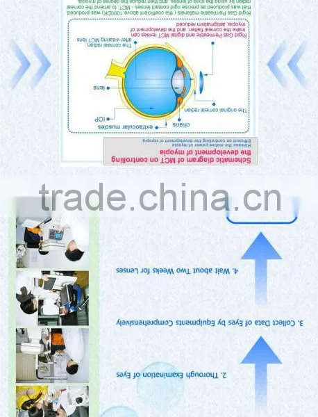 Web High-end MCT Technology MCT for Adult Amblyopia photo-2