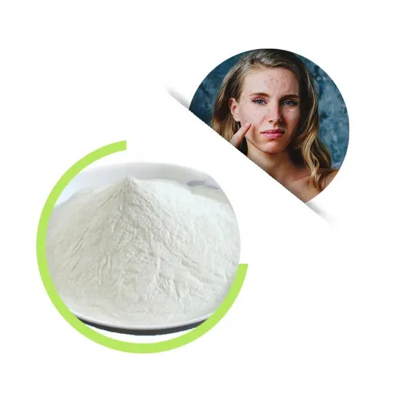 Anti Allergy Formula Probiotics For Health Supplements