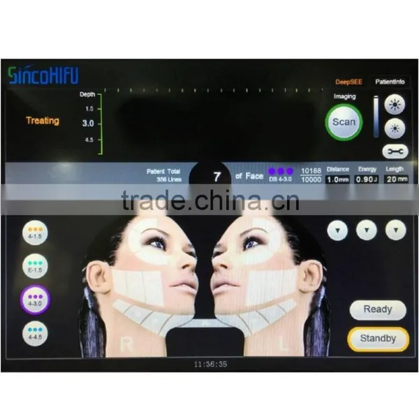 HIFU Lifting High Intensity Focused Ultrasound photo-4