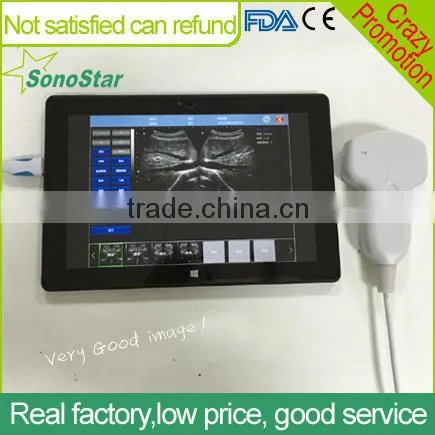 Sonostar Portable Cow Ultrasound Machine Pig Pregnancy Ultrasound Scanner Pirce UPad-10V