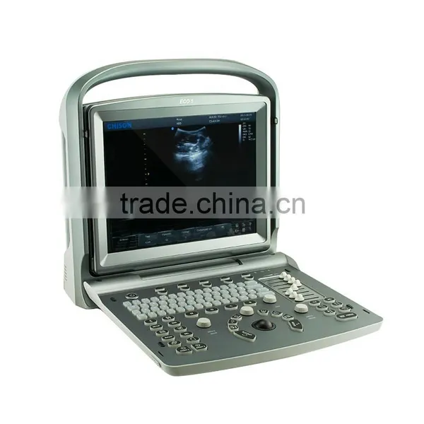 Cheap Price Portable/laptop 3D/4D Color Doppler Ultrasound System by CE ISO Approved photo-4