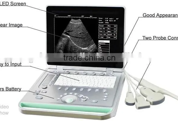 MCB-SS-7 15in Portable B Ultrasound Scanner