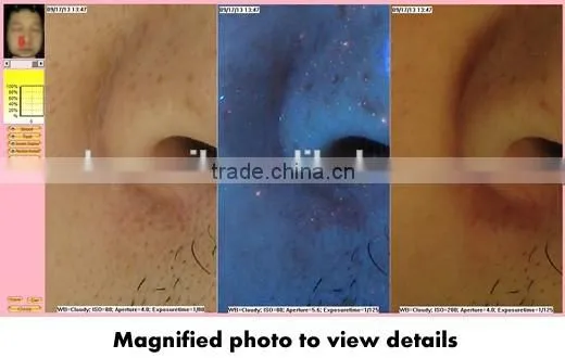 2014 Latest Magic Mirror System Skin Analyzer Equipment photo-4