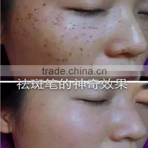 Promotion Laser Spot Removal Pen Freckle Mole photo-6