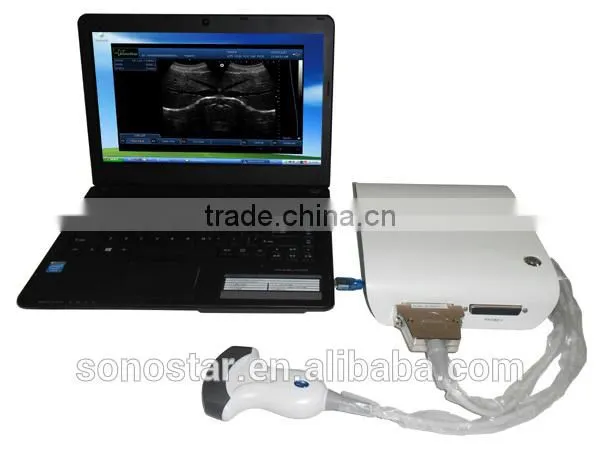 UBox-10 Ultrasound B Scanner Box photo-4