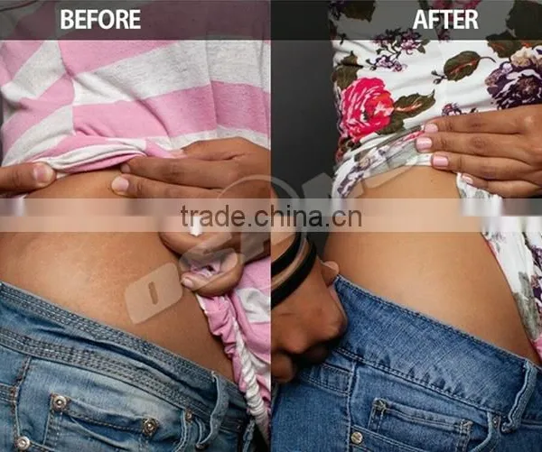 Body Slimming Supplier Of Cryolipolysis Beauty Device 3d Lipo Machine For Sale Zeltiq photo-6