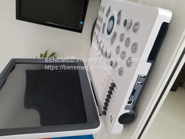 Ultraslim Notebook Type Black and White Ultrasound Scanner Machine Bw-8 photo-2