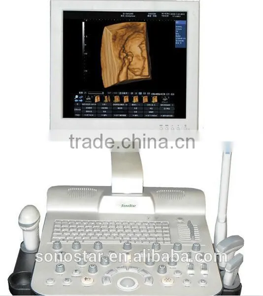 Ultrasound Scanner