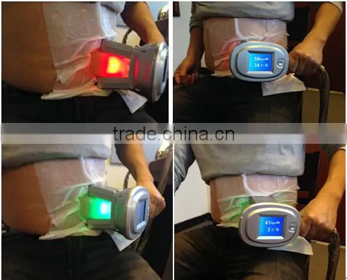 2016 Best Beauty Machine Zeltiq Cryolipolysis Machine Cool Sculpting photo-5