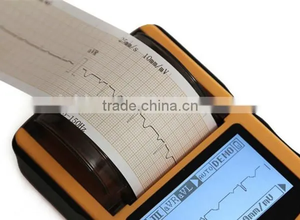 1-channel Handheld Electrocardiograph ECG EKG Machine Low Price photo-5
