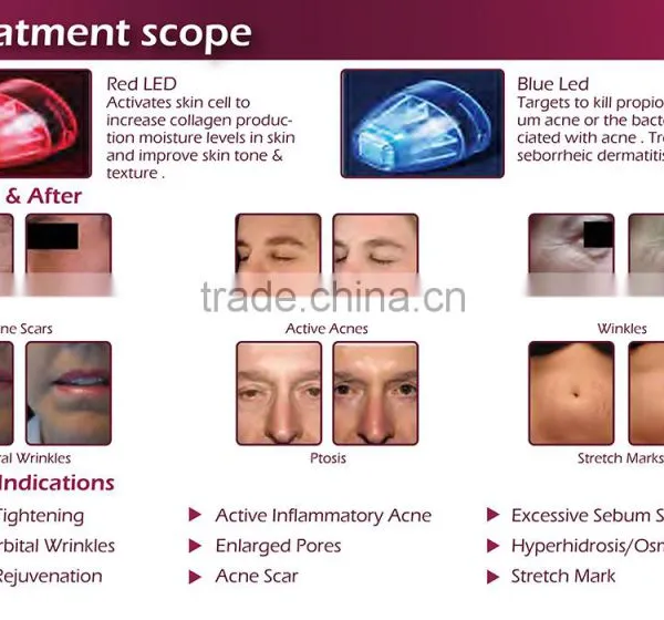 Easy to Delegates Microneedle Fractional rf Machine Radio Frequency Facial photo-5