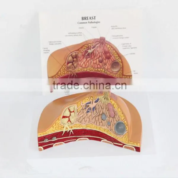 Medical Breast Disease Model Breast Anatomical Model Medical Training Model Breast Feeding Model photo-3
