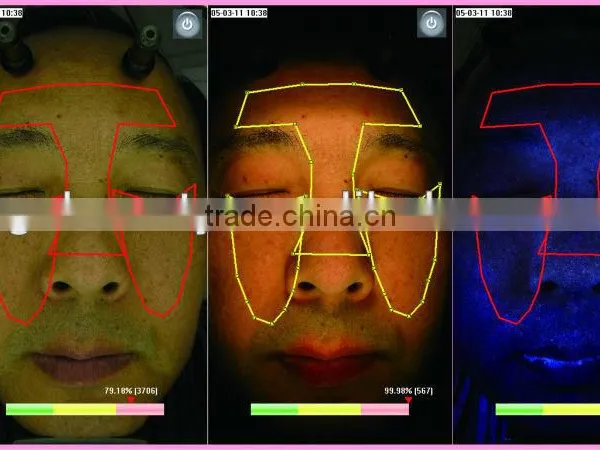 WT-03-B Big Facial Skin Analyzer Magic Mirror photo-3