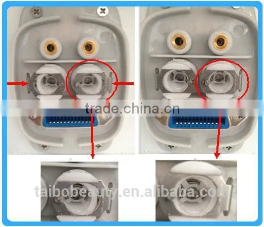 Hair Removal Machine Ipl Shr Machine/hair Removal Acne Treatment Skin Rejuvenation Shr/unhairing Beauty Equipment photo-3