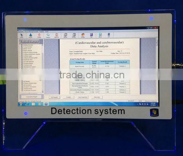 China Supplier 14 Inches Display Quantum Magnetic Body Analyzer photo-2