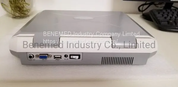 Notebook Type Black and White Ultrasound Scanner Medical Equipment photo-5