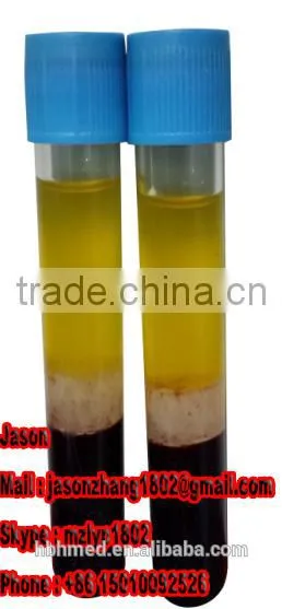 High Quality Injection Prp Kit photo-3