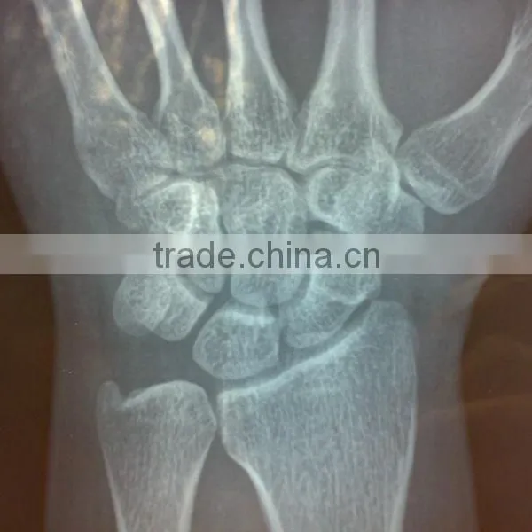 Medical Thermal x Ray Film,agfa Hns Film,Pet Clinic,medical Supplier,agfa Film Dt2b