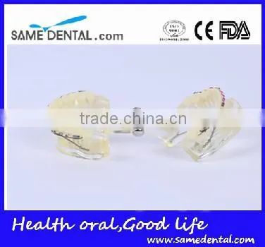 High Quality Dental Transparent Orthodontic Models School Teaching Demonstration photo-2