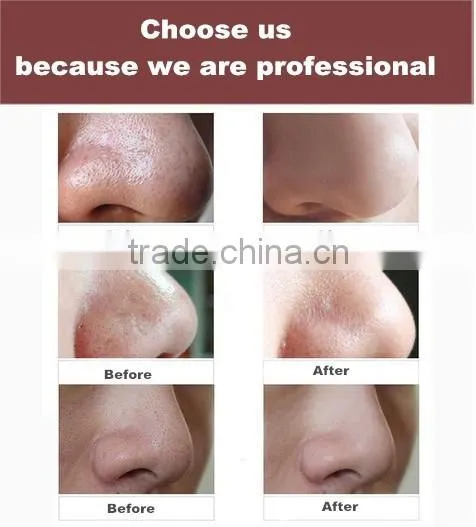Easy and Simple to Handle Microdermabrasion Machine Facial Machine Diamond Microdermabrasion Beauty Equipment photo-4