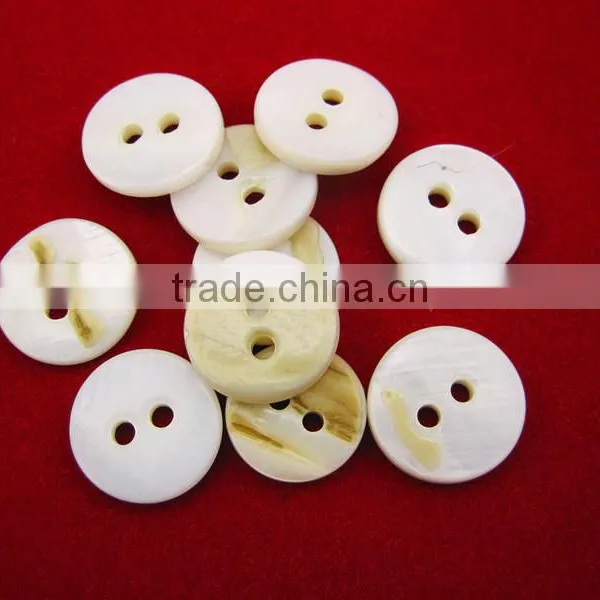 Shirt Buttons Plastic Button Resin Button photo-5