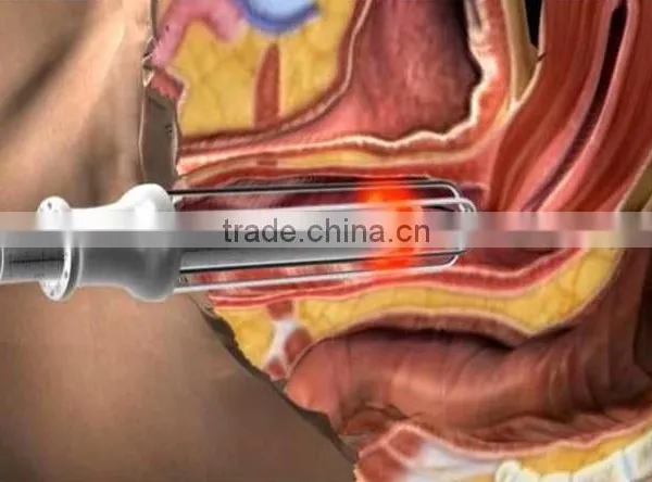 40w Fractional Co2 Laser Surgical Products Vaginal Applicator photo-5