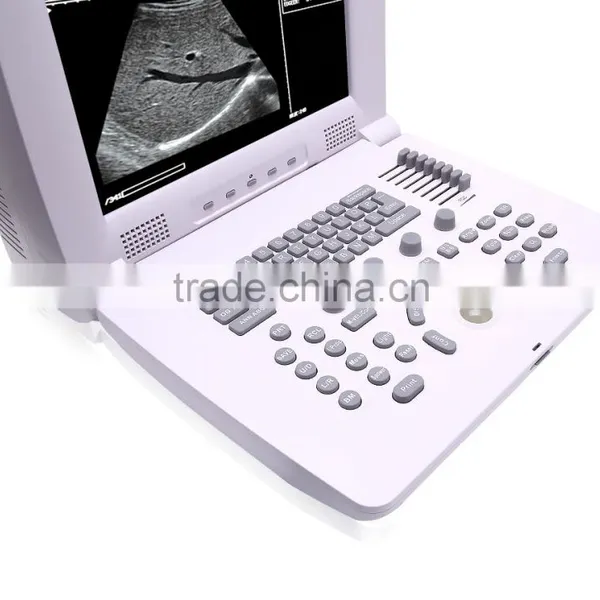 OB/GYN CE FDA Compact Multi-purpose Portable Doppler Ultrasound Scan photo-3
