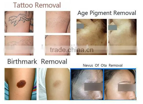Chinese Apolo ISO CE Approved Beauty Machine Top Tattoo Machine photo-5