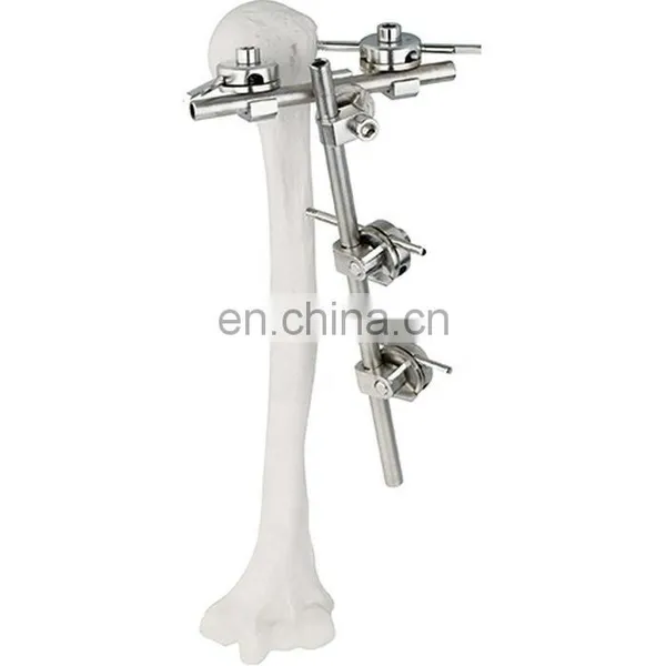 Guaranteed Quality Semi-circular External Fixator Orthopedic Surgical Implant photo-4