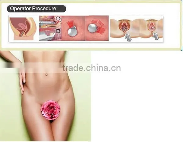 Manufacture Supply Professional Glass or RF Pipe 10600nm 40w Fractional Co2 Laser Acne Scar Removal photo-5