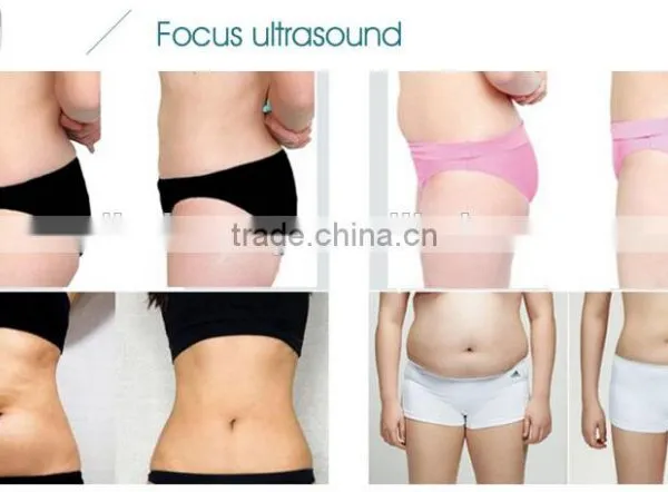 Professional High Intensity Focused Ultrasound Therapy Beauty Machine Weight Loss Machine Fat Burning Instrument photo-6