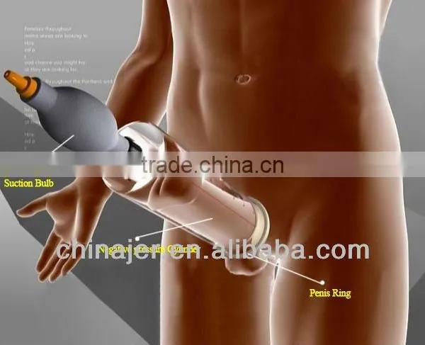 tens sex toy Shock wand estim sex toy – S & G main image 1