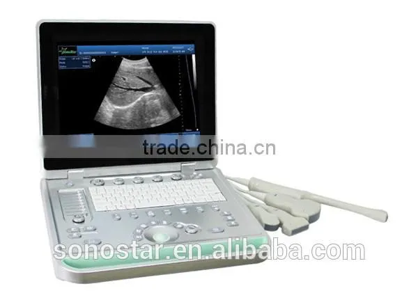 SS-9 PC Based Laptop Ultrasound B Scanner photo-3