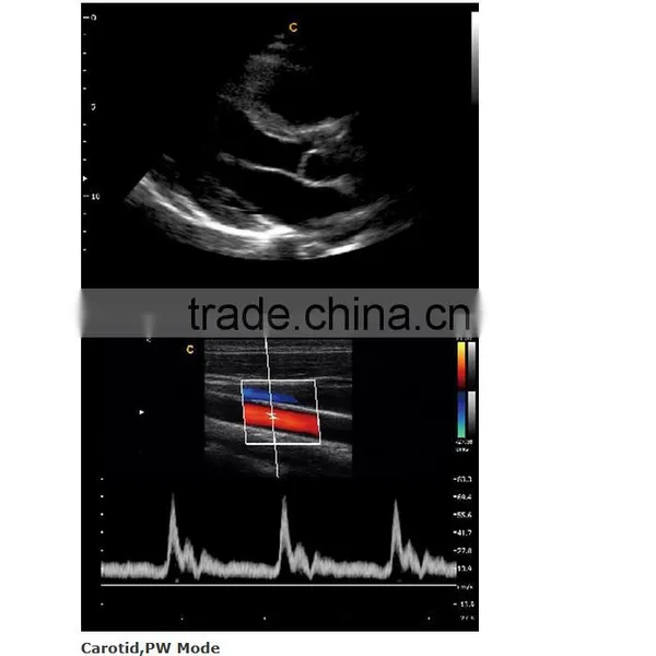 2016 New Portable Color Doppler(Optional 4D) for Cardiac Use photo-3