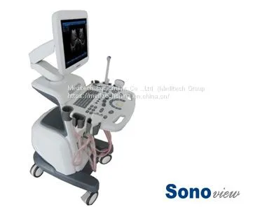 Top Quality 3D B/W Doppler Sonoview Machine Trolley Ultrasound Scanner photo-2