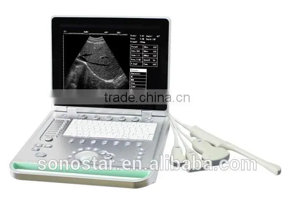 SS-7 Laptop Ultrasound Scanner photo-4