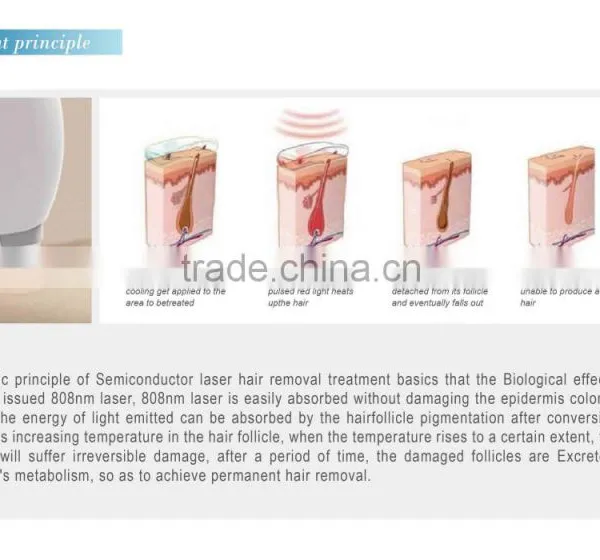 1-10HZ Newest 808nm Diode Laser Face Hair Removal Machine/810nm Portable Laser photo-3