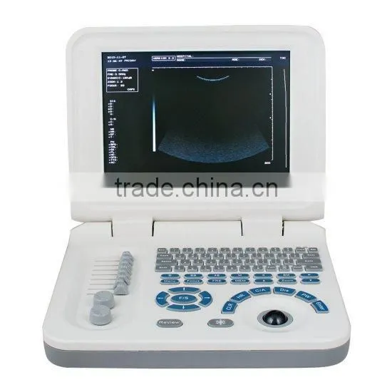 Full Digital Laptop B&W Ultrasound System Ultrasound Scanner Ultrasound Machine photo-4